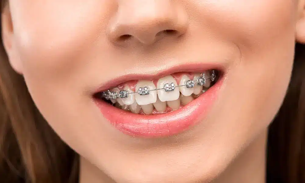 บริการ เชียงใหม่ สไลม์เดนทัลคลินิก