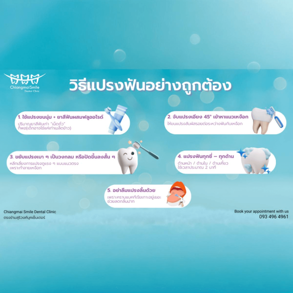 ทำฟัน เชียงใหม่