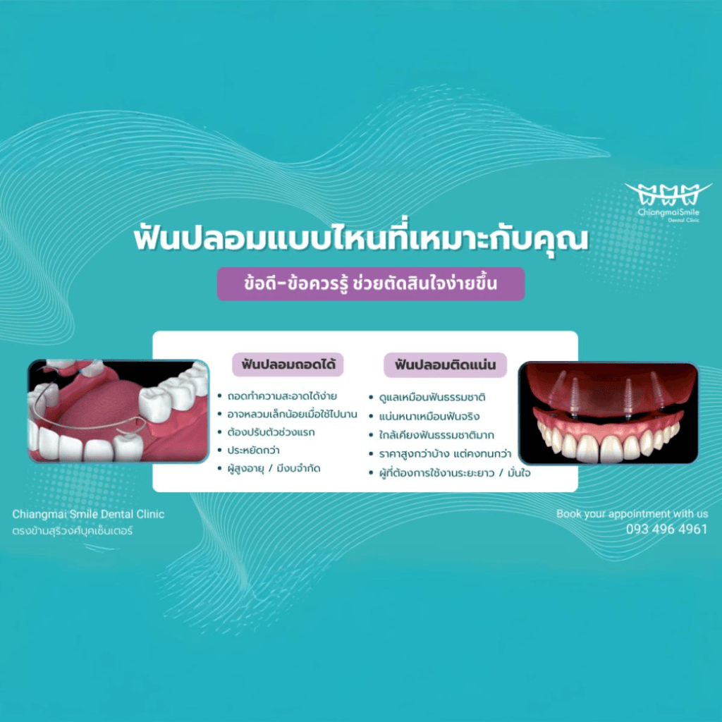 ฟันปลอม เชียงใหม่