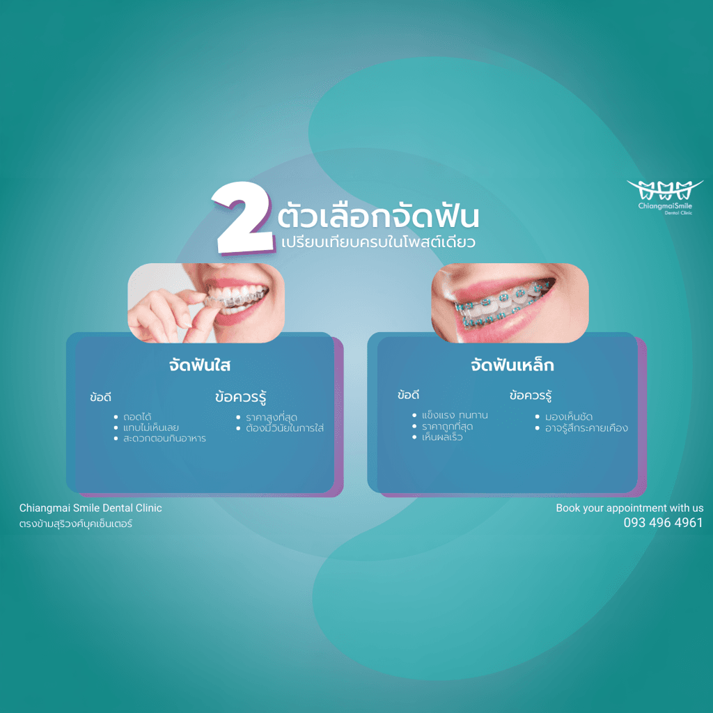 จัดฟัน เชียงใหม่