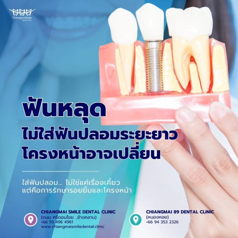 ฟันปลอม เชียงใหม่