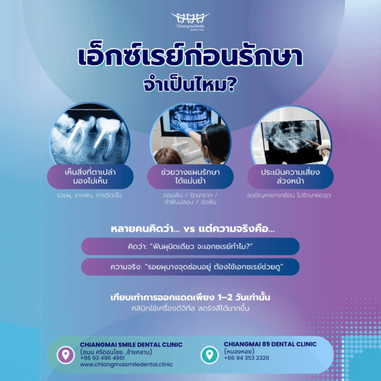 เอ็กซ์เรย์ฟัน เชียงใหม่