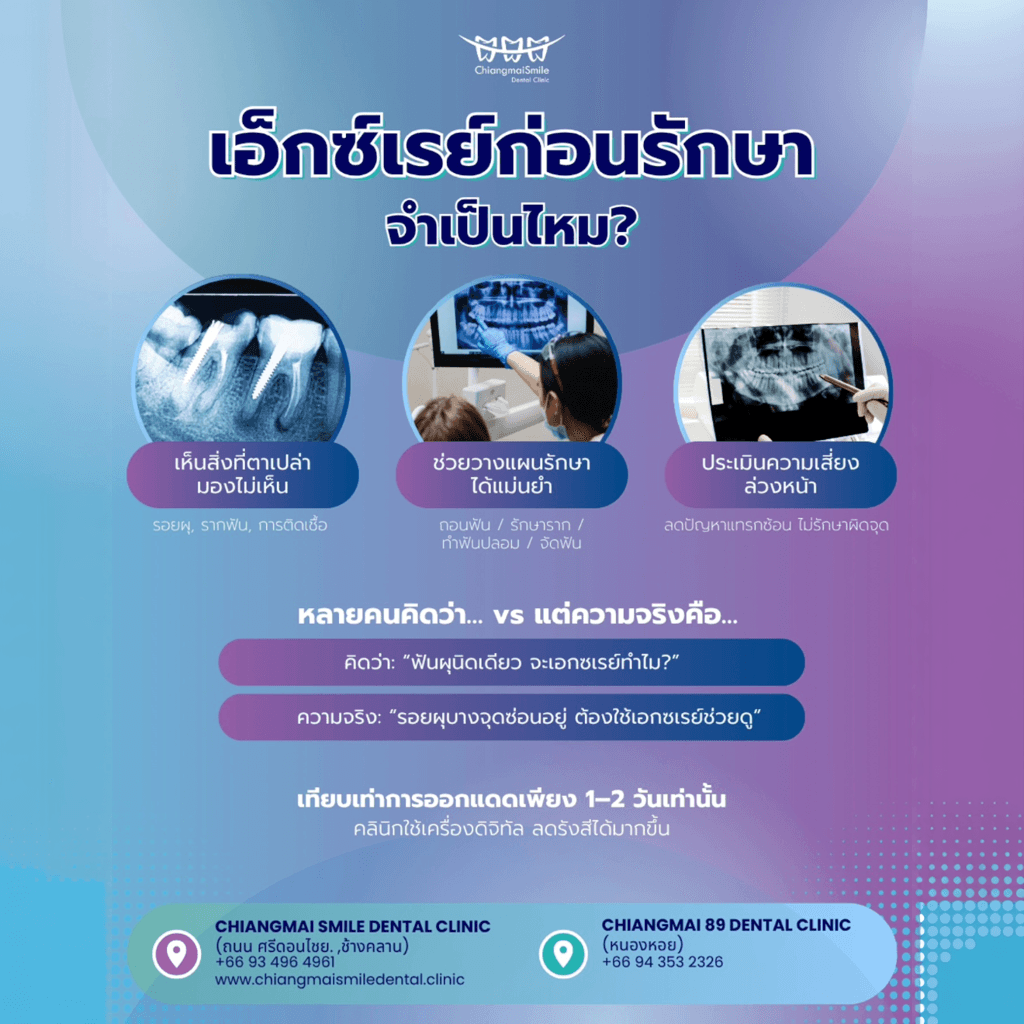 เอ็กซ์เรย์ฟัน เชียงใหม่