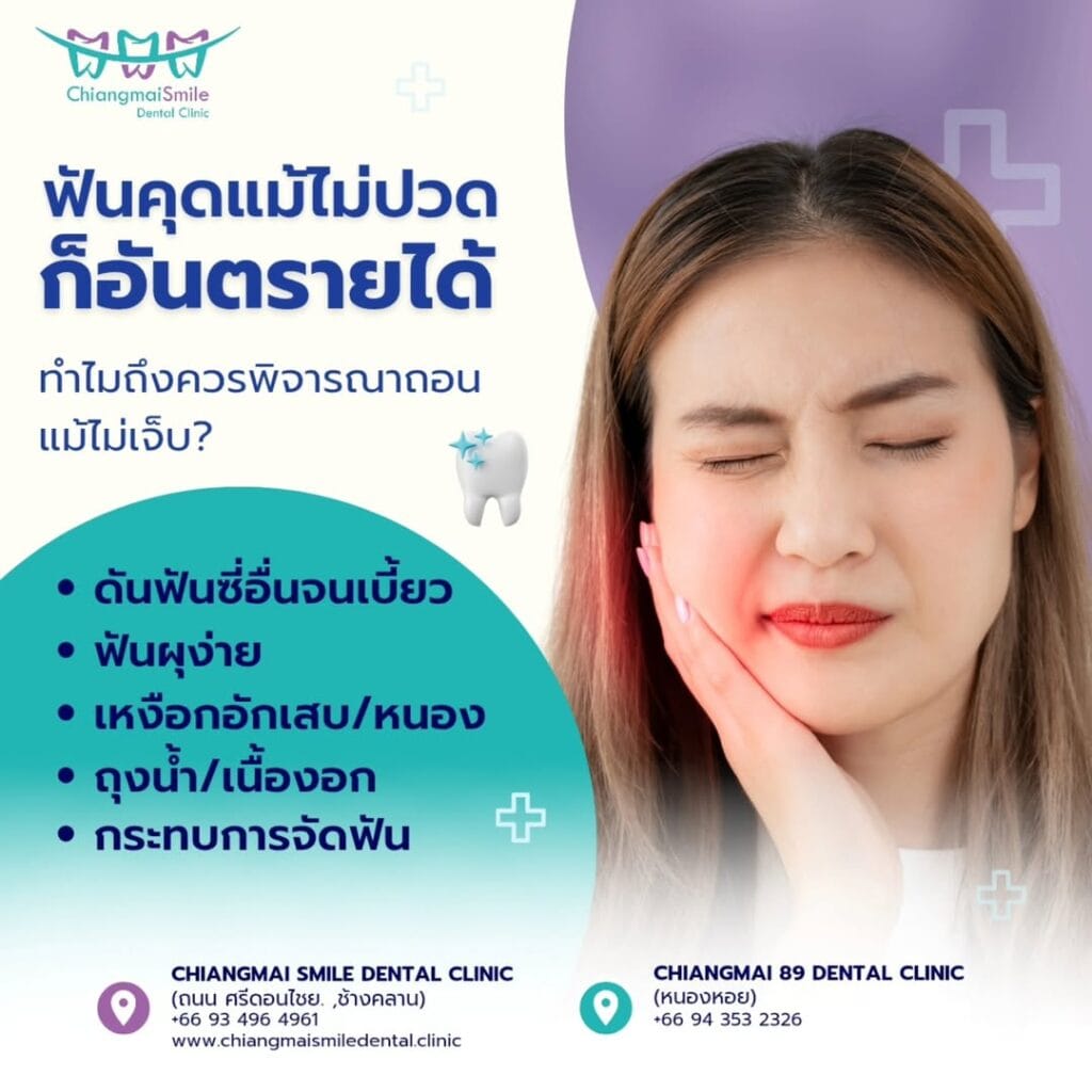 ถอนฟันคุด เชียงใหม่