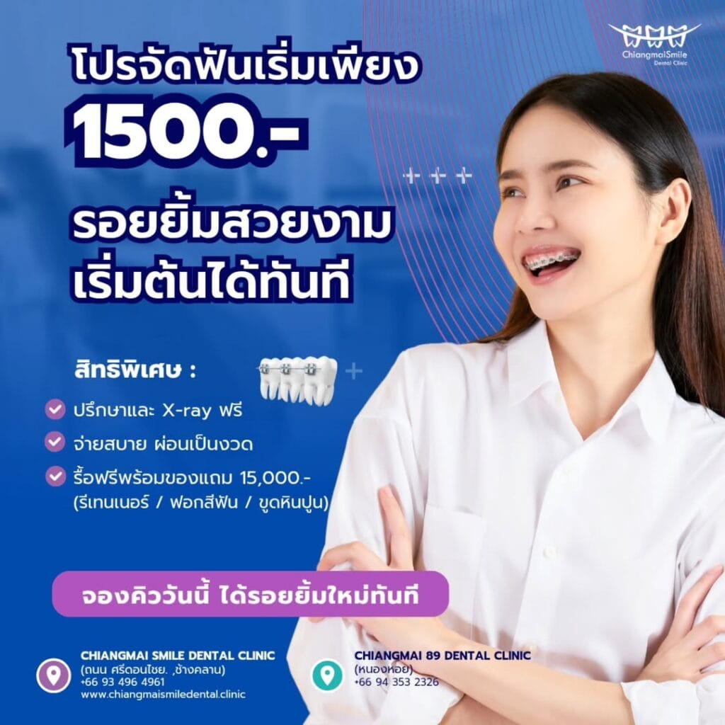 จัดฟัน เชียงใหม่