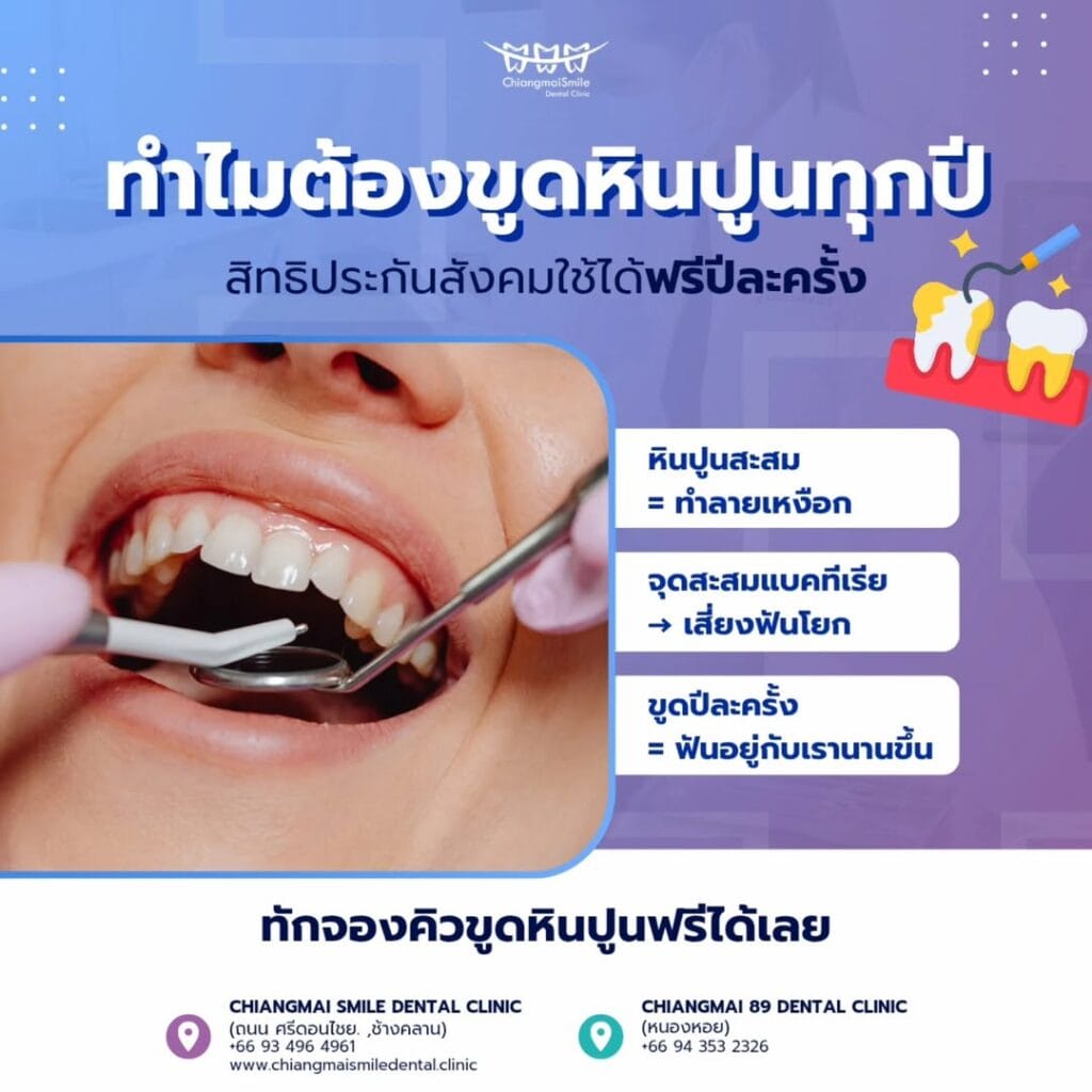 สิทธิ์ประกันสังคมทำฟันฟรี
