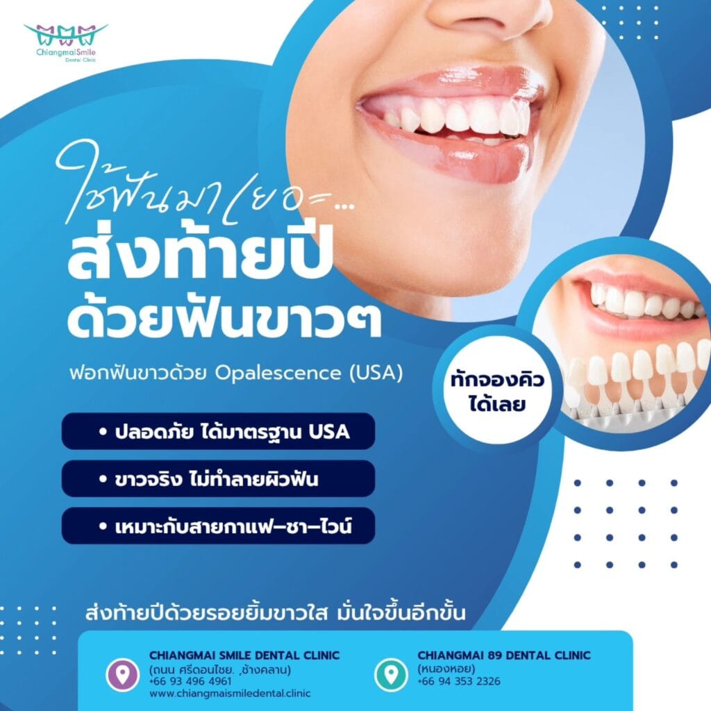 ฟอกฟันขาว เชียงใหม่