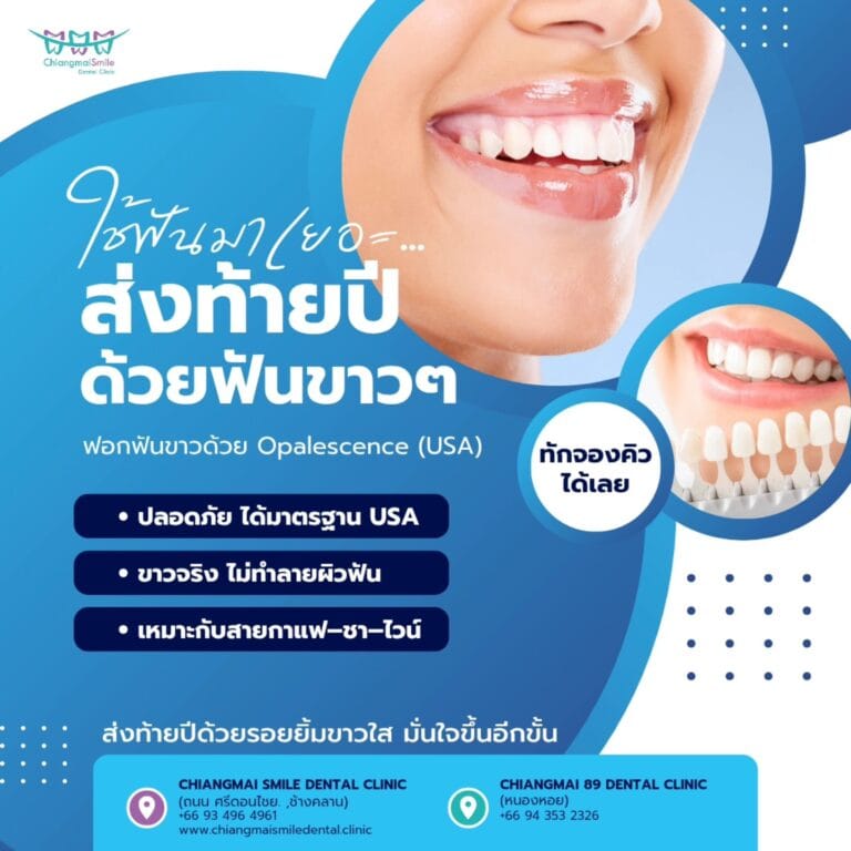 ฟอกฟันขาว เชียงใหม่