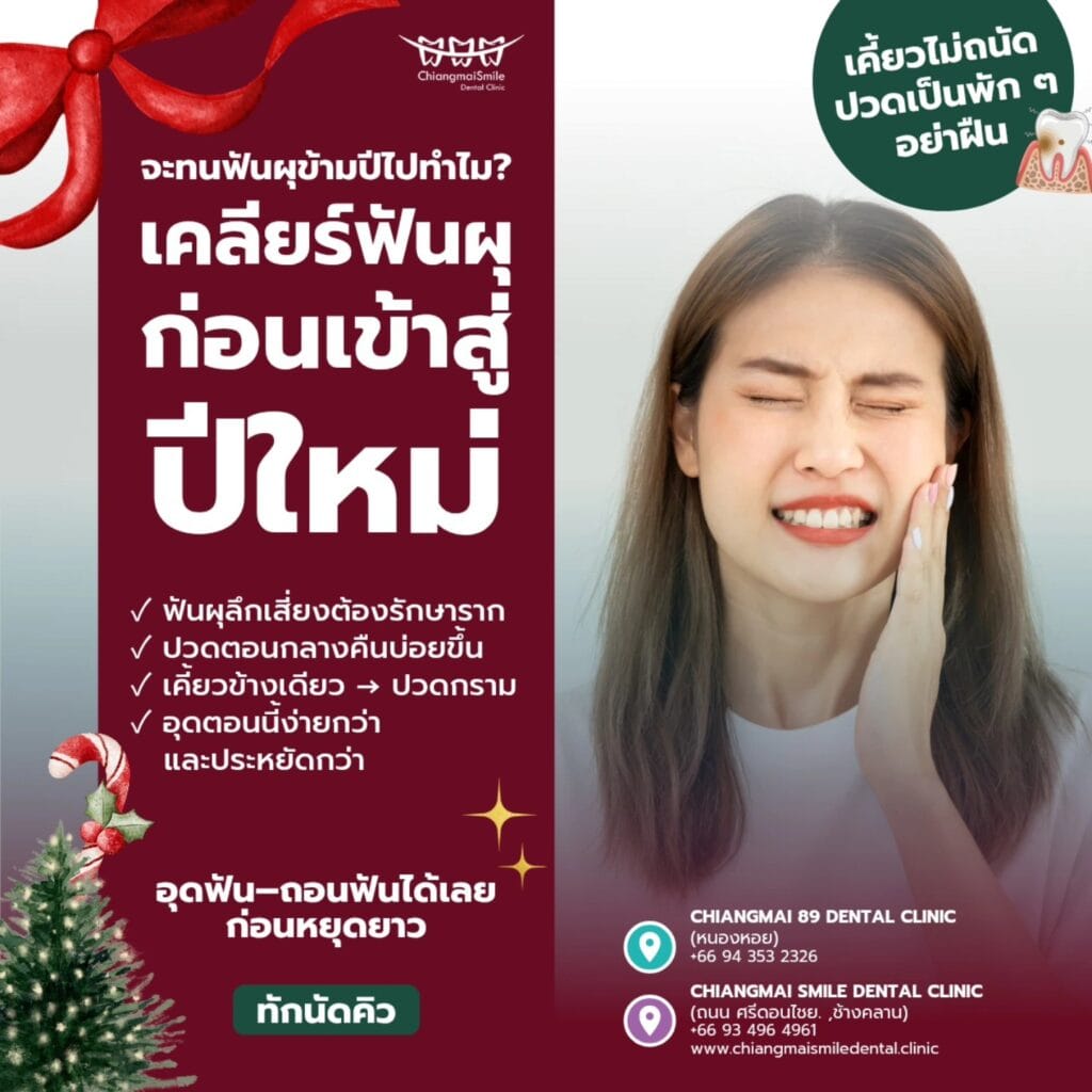 ทำฟัน เชียงใหม่