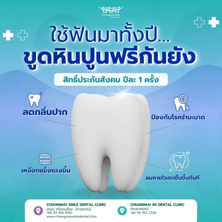 สิทธิประกันสังคมทำฟันฟรี เชียงใหม่