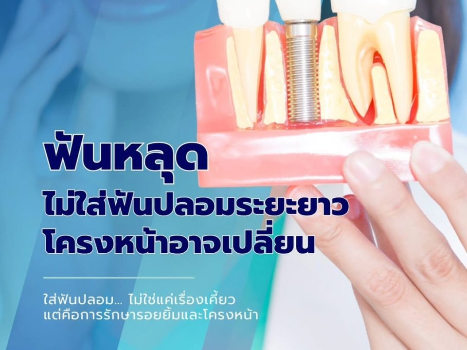 ฟันปลอม เชียงใหม่