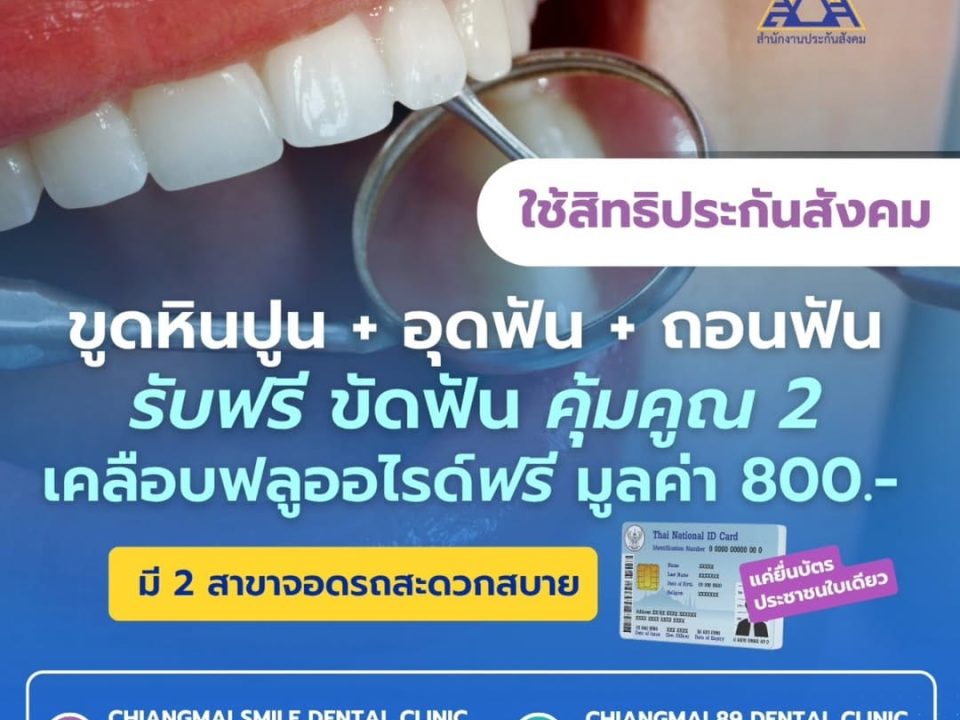 สิทธิ์ประกันสังคมทำฟันฟรี