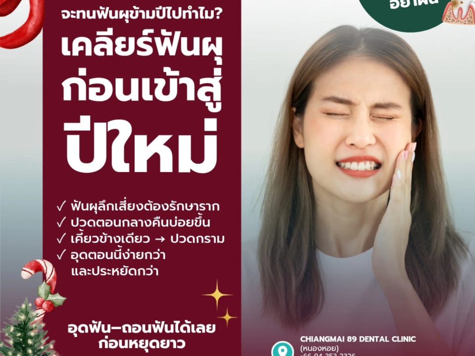 ทำฟัน เชียงใหม่